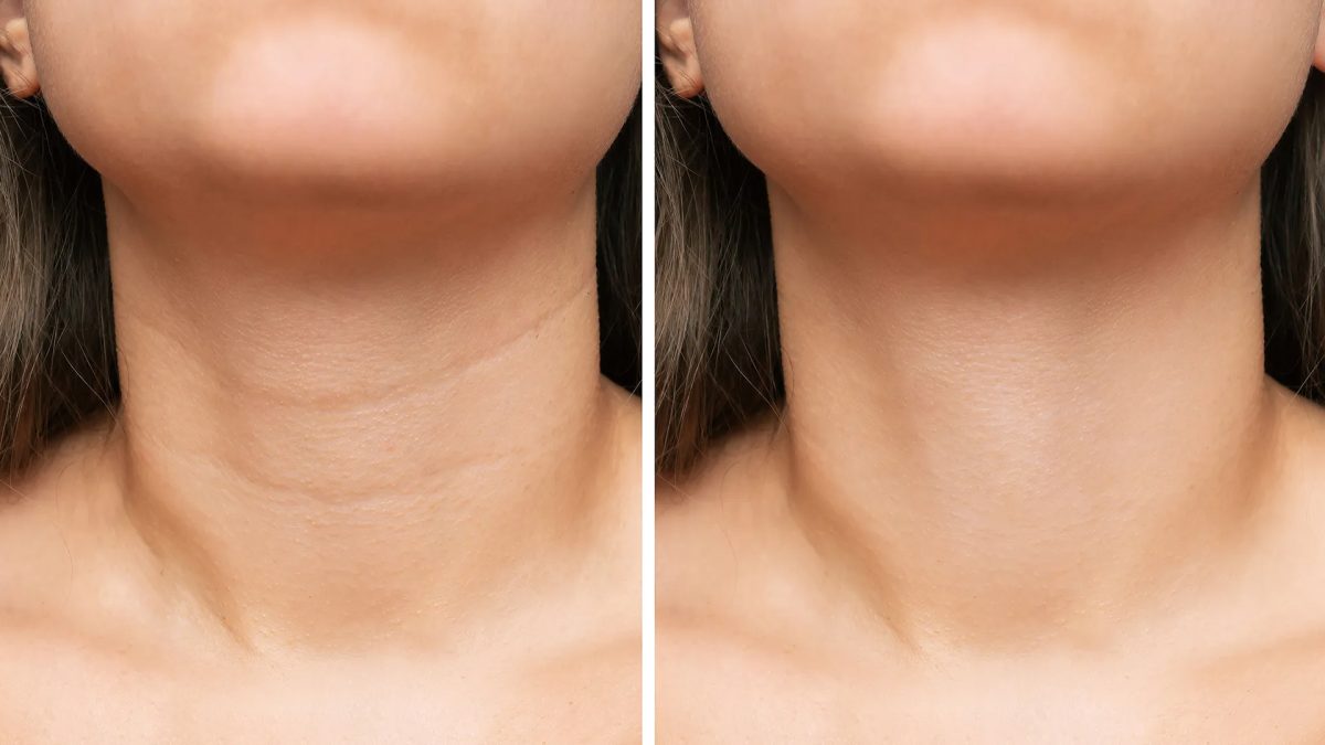Pharyngeal/Neck Pad