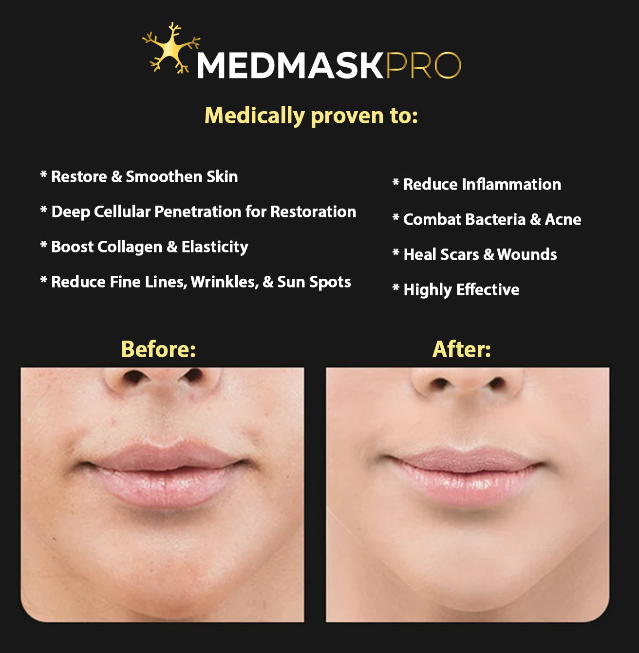 Medmask Pro - Red Light Therapy Mask & Neck Pad